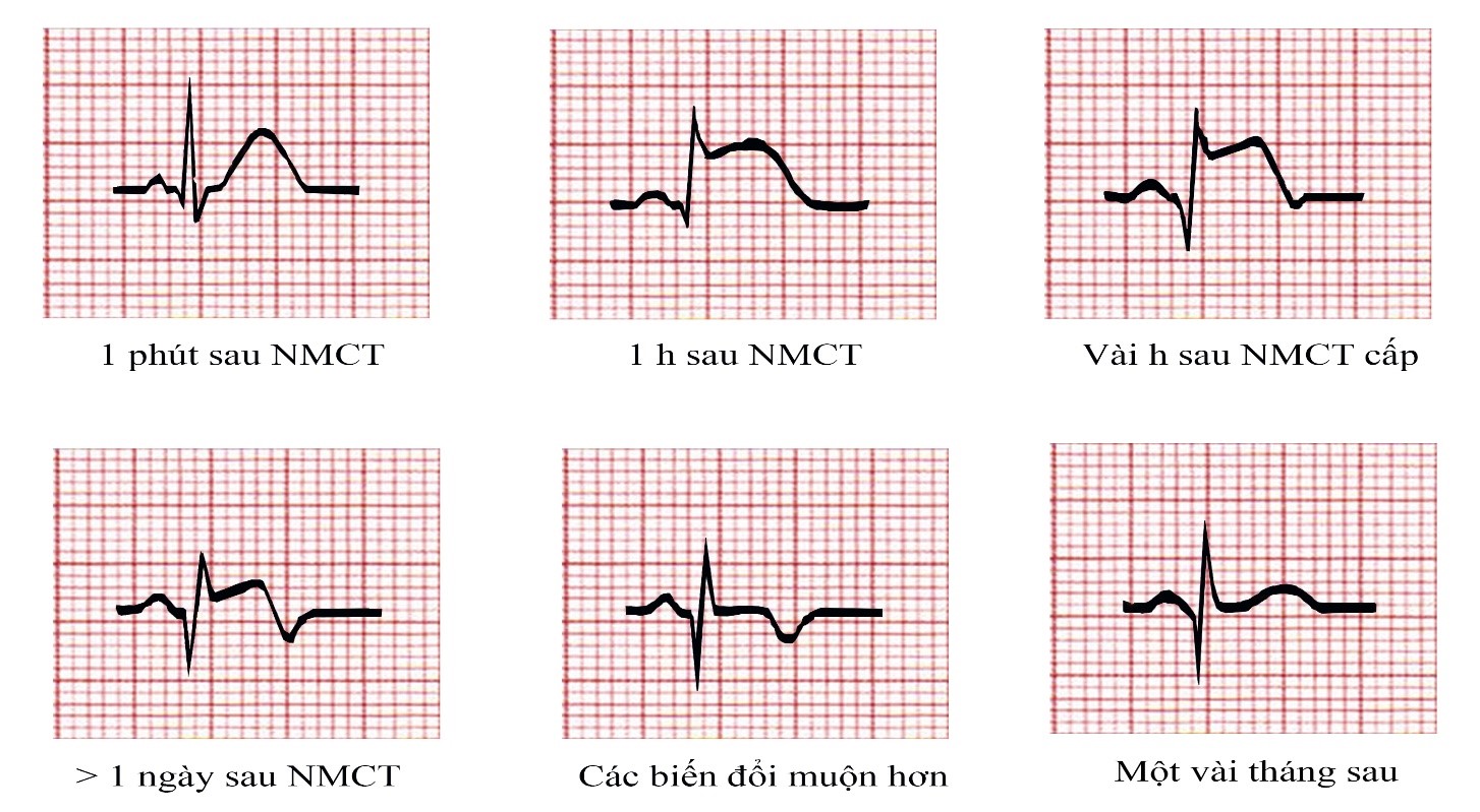 3. Dấu hiệu và triệu chứng